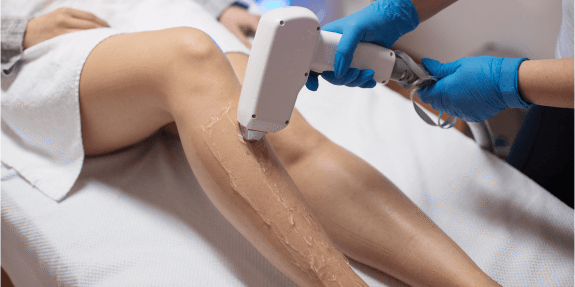 Kent Laser – Laser Hair Removal Blog (1) Woman having laser hair removal treatment on her leg at Kent Laser