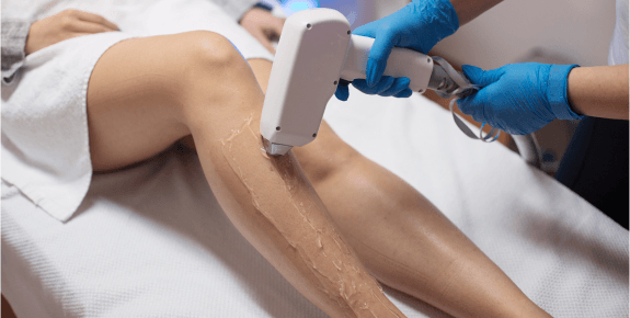 Kent Laser – Laser Hair Removal Blog (1) Woman having laser hair removal treatment on her leg at Kent Laser