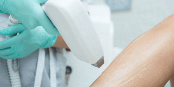 Kent Laser – Laser Hair Removal Guide Blog (1) Laser hair removal procedure