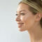 woman smiling, with smooth skin, after polynucleotides treatment in Kent
